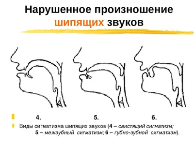 Автоматизация звуков С и Ш - Задания для детей и родителей | Звуки букв,  Дошкольные проекты, Логопедия