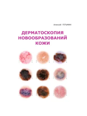 Иллюстрация 15 из 20 для Дифференциальная диагностика в дерматологии. Атлас  - Эштон, Леппард, Купер | Лабиринт - книги.