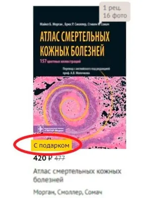 Иллюстрация 10 из 20 для Дифференциальная диагностика в дерматологии. Атлас  - Эштон, Леппард, Купер | Лабиринт - книги.