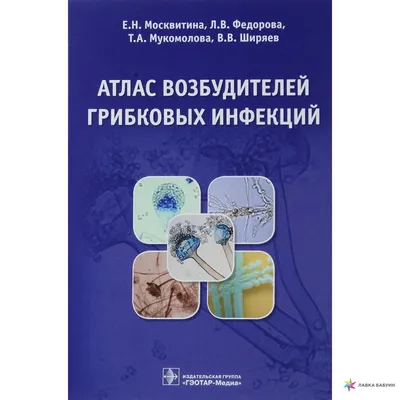 Купить книгу «Заболевания, травмы и пороки развития слюнных желёз. Атлас»  Афанасьев В.В., Абдусаламов М.Р.; Под ред. В.В. Афанасьева • ISBN  978-5-9704-7423-5 • 2023 • Topar.uz в Ташкенте, с доставкой по Узбекистану