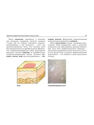 Dermatologist's role in the early diagnosis of oncologic diseases - Akimov  - Consilium Medicum