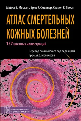 Морган М.Б., Смоллер Б.Р., Сомач С.К. \"Атлас смертельных кожных болезней\" —  купить в интернет-магазине по низкой цене на Яндекс Маркете