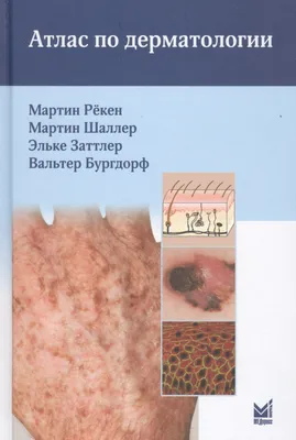 Атлас по дерматологии (Мартин Рёкен) - купить книгу с доставкой в  интернет-магазине «Читай-город». ISBN: 978-5-00-030535-5