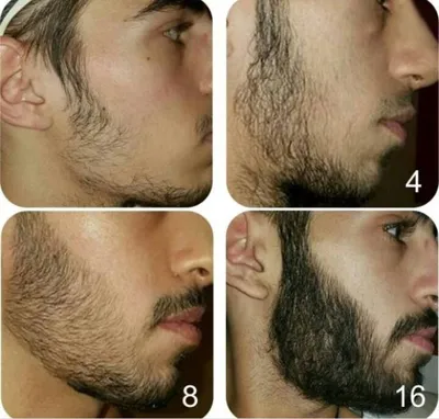 Как борода спасает от удара в челюсть