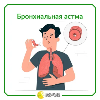 Бронхиальная астма — Центральная городская больница № 7