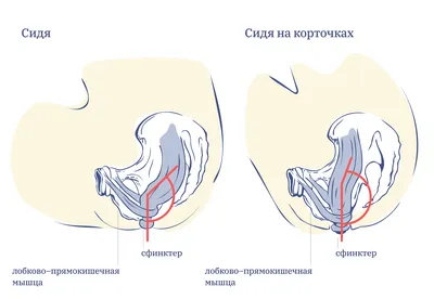 Почему нельзя долго сидеть в туалете: ответ проктолога