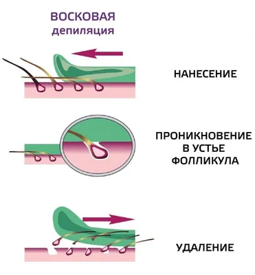 Способы удаления волос | Как в домашних условиях делать депиляцию воском?