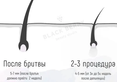 Депиляция воском, шугаринг | Воронеж