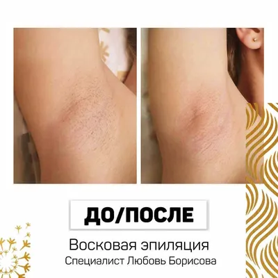 Депиляция воском по маслу. 😍 Новый метод депиляции воском без боли для  чувствительной кожи.12+ - YouTube