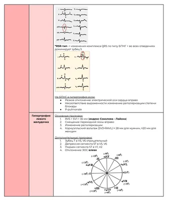 Расшифровка ЭКГ - Советчица