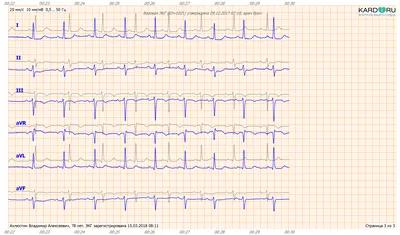 АЛГОРИТМЫ ЭКГ-ДИАГНОСТИКИ – add3d.ru
