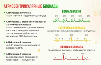 ❤️ ЭКГ сердца в платной клинике на Молодежной - Цена 500 рублей