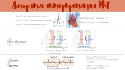 Электрокардиография (ЭКГ) в медицинском центре МедЭлит | Сделать ЭКГ в  Москве