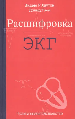 Ответы Mail.ru: Просьба помочь с расшифровкой ЭКГ