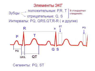 Расшифровка ЭКГ норма, таблица, параметры, элементы.