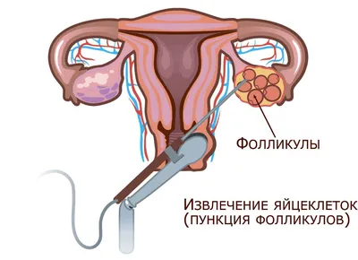 Процедура ЭКО от начала до конца по времени, сколько стоит: основные этапы,  как проводится | Национальный центр репродукции «ЭКО-Содействие»