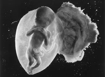 Эмбриональное развитие, подготовка к ЕГЭ по биологии