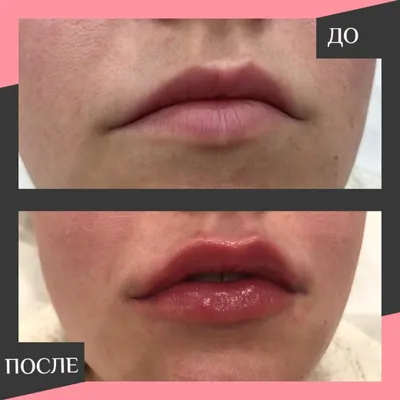Какая форма губ вам нравится больше? | ЗЕЛЛО АЯГОЗ | ВКонтакте