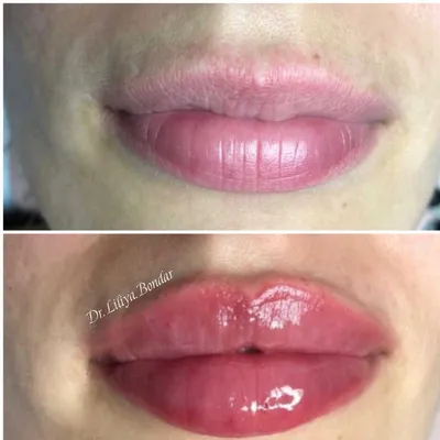 Коррекция формы губ с помощью макияжа: увеличиваем губы без инъекций!