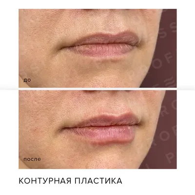 Luxury Permanent Make up by Anna Savina: Выбор формы губ
