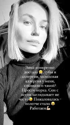 Полина Гагарина страдает зимой от крапивницы