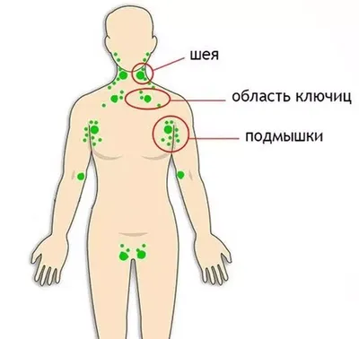 Компьютерная томография лимфатических узлов с контрастом в Краснодаре —  УРО-ПРО
