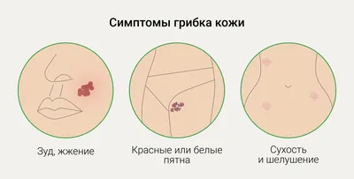 Лечение грибка кожи | Асмедия | Санкт-Петербург (СПб)