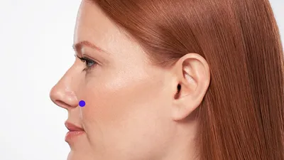 Красивый нос — это тот, который идеально подходит вашему лицу - Op. Dr.  Soner Tezcan