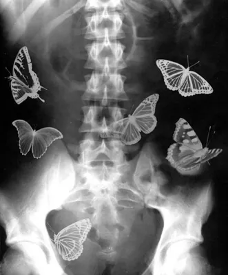 Бабочки в животе красивые картинки - 77 фото