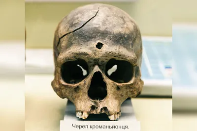 Тайна древних хирургов: зачем наши предки сверлили черепа наживую - РИА  Новости, 22.08.2021