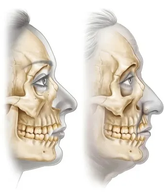 💙 󾬓 Остеосаркома черепа 💙 󾬓 Диагностика и лечение рака костей черепа в  Запорожье