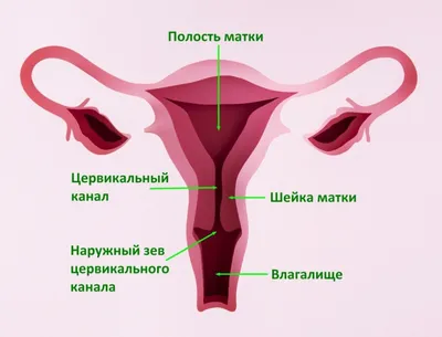 Удаление эрозии, эктопии шейки матки - лазерное и радиоволновое лечение