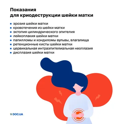 Радиоволновое лечение эрозии шейки матки | Полезное от клиники «Геном» в  Томске