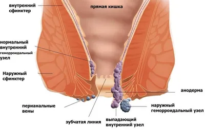 Мазь от геморроя / Крем от геморроя / Мускусная мазь от геморроя 10 гр -  купить с доставкой по выгодным ценам в интернет-магазине OZON (649939416)