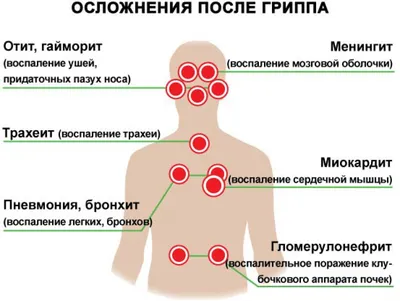 ИМХ РАН: Профилактика гриппа и ОРВИ
