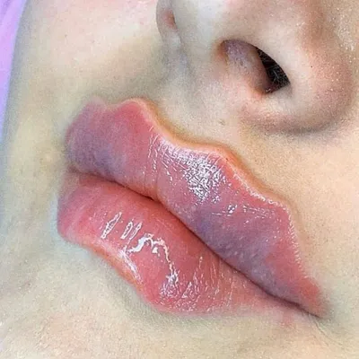 Почему губы меняют цвет?