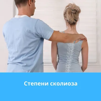 Сколиоз не лечится со временем » Bioloji Təbabət Klinikası