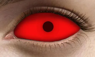 Красные глаза — единственный внешний признак этой смертельно опасной  болезни | АиФ Новосибирск | Дзен