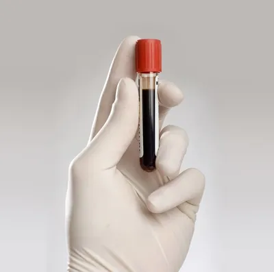 Сколько жизней спасет переливание искусственной крови: Статьи общества ➕1,  12.04.2023