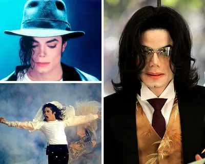 Болезнь Майкла Джексона как можно предотвратить и вылечить витилиго |  GreenPost