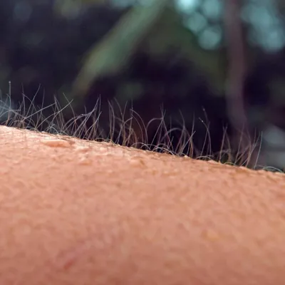 Эстетический холодок» или «кожный оргазм»: что означают мурашки по коже при  прослушивании музыки.