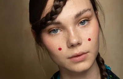Милиумы на лице: почему они появляются и как от них избавиться | Решение  проблем в клинике BeautyWay Clinic