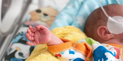 В Перинатальном центре отметят Международный день недоношенных детей |  Новости Йошкар-Олы и РМЭ