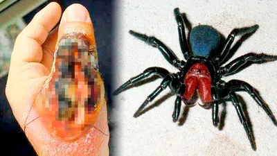 5 самых опасных пауков, которые водятся в Украине - Главред
