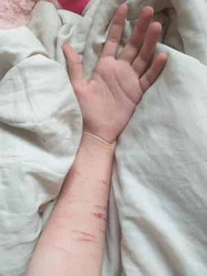 Тело в синяках и порезах: родители повешенного в Шымкенте парня не верят в  суицид