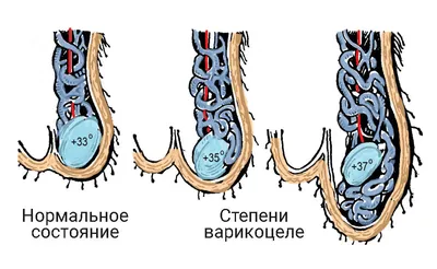 Операция Мармара