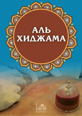 Как работает хиджама ! — Авиценна Хиджама на TenChat.ru