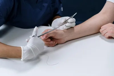 хирург, выполняющий операцию против больного Иллюстрация вектора -  иллюстрации насчитывающей перчатки, здоровье: 231413690