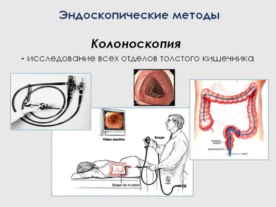 Рентген кишечника с барием в Москве | Клиника академика Ройтберга