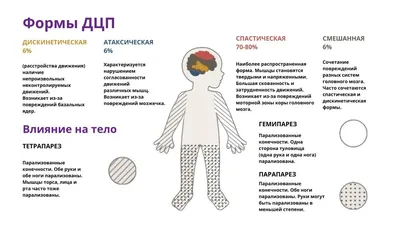 5 мифов о церебральном параличе | Тифлоцентр Вертикаль